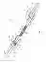 Fig. 03 - Rapid palatal expander and method for the making thereof