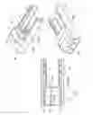 Fig. 06 - Rapid palatal expander and method for the making thereof