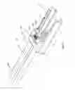 Fig. 10 - Rapid palatal expander and method for the making thereof
