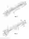 Fig. 06 - Orthodontic archwire