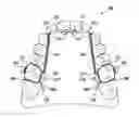 Fig. 01 - Dental arch and airway expander device and method