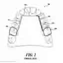 Fig. 02 - Dental arch and airway expander device and method