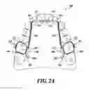 Fig. 03 - Dental arch and airway expander device and method
