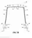 Fig. 04 - Dental arch and airway expander device and method