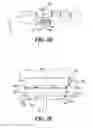 Fig. 06 - Dental arch and airway expander device and method