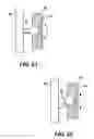 Fig. 13 - Dental arch and airway expander device and method