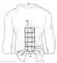 Fig. 01 - Devices and methods for preventing incisional hernias