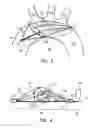 Fig. 03 - Intravascular device with multiple leaflets