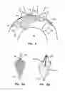 Fig. 04 - Intravascular device with multiple leaflets