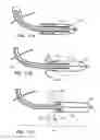 Fig. 09 - Intravascular device with multiple leaflets