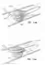 Fig. 12 - Intravascular device with multiple leaflets