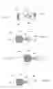 Fig. 02 - Bronchoscopic lung volume reduction valve