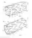 Fig. 02 - Intralumenal stent graft fixation