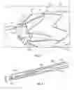 Fig. 04 - Intralumenal stent graft fixation