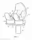 Fig. 02 - LIGAMENT FIXING AND A METHOD OF ATTACHING A LIGAMENT