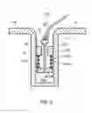 Fig. 05 - LIGAMENT FIXING AND A METHOD OF ATTACHING A LIGAMENT
