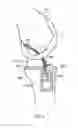 Fig. 06 - LIGAMENT FIXING AND A METHOD OF ATTACHING A LIGAMENT