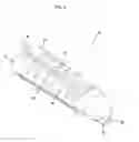 Fig. 03 - Femoral fixation