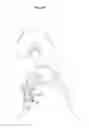 Fig. 08 - Femoral fixation