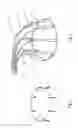 Fig. 03 - Heart valve repair and replacement