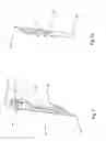 Fig. 06 - Heart valve repair and replacement
