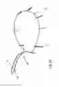 Fig. 12 - Heart valve repair and replacement
