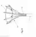 Fig. 19 - Heart valve repair and replacement