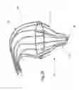 Fig. 23 - Heart valve repair and replacement