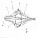 Fig. 24 - Heart valve repair and replacement