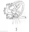 Fig. 32 - Heart valve repair and replacement
