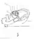 Fig. 33 - Heart valve repair and replacement
