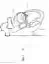 Fig. 35 - Heart valve repair and replacement