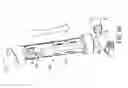 Fig. 38 - Heart valve repair and replacement