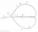 Fig. 01 - Encircling implant delivery systems and methods