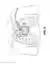 Fig. 07 - Method and device for percutaneous left ventricular reconstruction