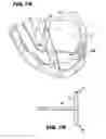 Fig. 09 - Method and device for percutaneous left ventricular reconstruction