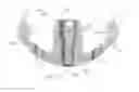 Fig. 04 - Prosthetic articulation surface mounting