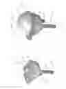 Fig. 10 - Prosthetic articulation surface mounting