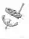 Fig. 11 - Prosthetic articulation surface mounting