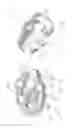 Fig. 15 - Prosthetic articulation surface mounting