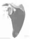 Fig. 24 - Prosthetic articulation surface mounting