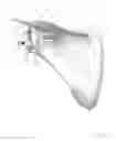 Fig. 30 - Prosthetic articulation surface mounting