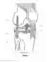 Fig. 02 - Total knee arthroplasty system and method