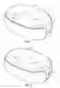Fig. 02 - Percutaneous implantable nuclear prosthesis