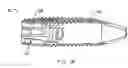 Fig. 04 - Articulating spacer