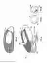 Fig. 05 - Articulating spacer