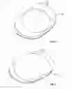 Fig. 03 - Intervertebral disc implant