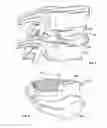 Fig. 04 - Intervertebral disc implant