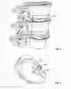 Fig. 06 - Intervertebral disc implant