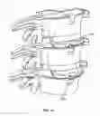 Fig. 10 - Intervertebral disc implant